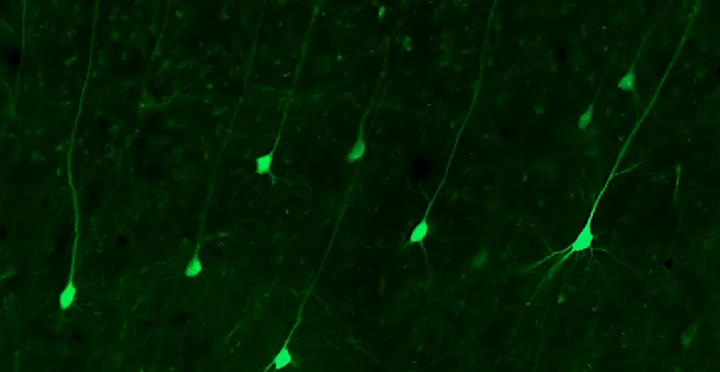 Feedback cells in IT cortex