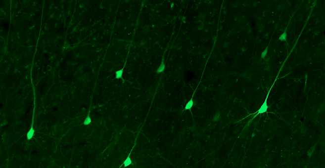 Feedback cells in IT cortex